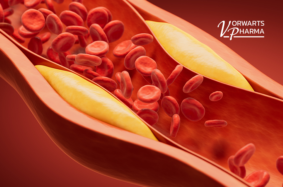 Podwyższony cholesterol: dlaczego wskaźniki się zmieniają i jaką rolę odgrywa dieta